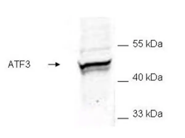WB analysis of recombinant GST-tagged human ATF3 protein using GTX48669 ATF3 antibody. Dilution : 1:200