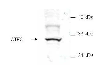 WB analysis of recombinant HA-tagged human ATF3 protein using GTX48669 ATF3 antibody. Dilution : 1:200