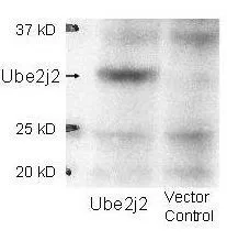 Western blot using GeneTexs affinity purified anti-Ube2j2 antibody shows detection of Ube2j2 in 293 cells over-expressing Myc-Ube2j2 (Lane 1). Lane 2 contains lysate from mock-transfected 293 cells.