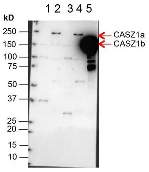 Western Blot of Anti-CASZ1 Antibody.