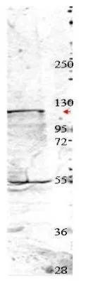 Western blot using GeneTex's affinity purified anti-Nedd4 antibody shows detection of a 115 kDa band corresponding to endogenous Nedd4 (arrowhead) in MDA-MB-435S cell lysates.