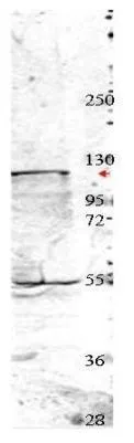 Western blot using GeneTexs affinity purified anti-Nedd4 antibody shows detection of a 115 kDa band corresponding to endogenous Nedd4 (arrowhead) in MDA-MB-435S cell lysates. Primary antibody was used at a 1:350 dilution followed by reaction with a 1:20,000 dilution of HRP goat anti-rabbit IgG. Western blot using GeneTexs affinity purified anti-Nedd4 antibody shows detection of a 115 kDa band corresponding to endogenous Nedd4 (arrowhead) in MDA-MB-435S cell lysates. Primary antibody was used at a 1:350 dilution followed by reaction with a 1:20,000 dilution of HRP goat anti-rabbit IgG.