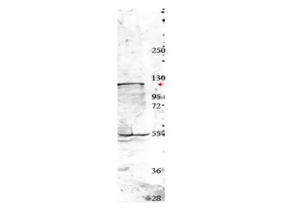 WB analysis of MDA-MB-435S whole cell lysate using GTX48706 NEDD4 antibody. Dilution : 1:350