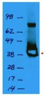 Western blot using GeneTex's affinity purified anti-Lac I antibody shows detection of a 38 kDa band corresponding to recombinant Lac I (arrowhead).