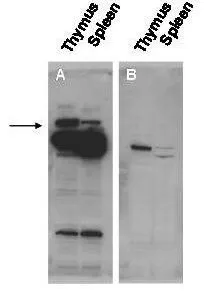 Western blot using GeneTex Immuno-chemicals affinity purified anti-Pogz antibody shows detection of Pogz protein (arrowhead) in adult mouse thymus and spleen tissue lysate (Panel A).
