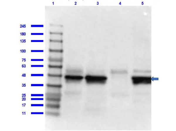 WB analysis of various samples using GTX48715 IL7 Receptor alpha antibody. Lane 1 : Protein ladder Lane 2 : Human spleen tissue lysate Lane 3 : U251 whole cell lysate Lane 4 : Human pancreas tissue lysate Lane 5 : Molt-4 whole cell lysate Dilution : 1 microg/mL