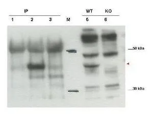 Western blot using GeneTexs affinity purified anti-Cybr antibody shows detection of endogenous Cybr from mouse splenocytes using anti-Cybr antibody to immunoprecipitate and western blot (lanes 1-3). Lane 1 shows reactivity of pre-immune sera. Lane 2 shows endogenous Cybr detected with antibody. Lane 3 shows no band detected in lysates prepared from splenocytes of Cybr knock-out mouse. Lane 5 shows direct western blot of wt splenocytes. Lane 6 shows direct western blot of knock out mouse. Western blot using GeneTexs affinity purified anti-Cybr antibody shows detection of endogenous Cybr from mouse splenocytes using anti-Cybr antibody to immunoprecipitate and western blot (lanes 1-3). Lane 1 shows reactivity of pre-immune sera. Lane 2 shows endogenous Cybr detected with antibody. Lane 3 shows no band detected in lysates prepared from splenocytes of Cybr knock-out mouse. Lane 5 shows direct western blot of wt splenocytes. Lane 6 shows direct western blot of knock out mouse.