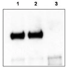 Mouse cortex lysate was immunoprecipitated with anti-TrkCT1 antibody and further blotted with affinity purified anti-TrkCT1. Lane 1 is wild-type cortex lysate, Lane 2 is Tamalin knock-out cortex lysate, and Lane 3 is TrkCT1 knock-out cortex lysate. The membrane was probed with the primary antibody at a 1:6,000 dilution. Mouse cortex lysate was immunoprecipitated with anti-TrkCT1 antibody and further blotted with affinity purified anti-TrkCT1. Lane 1 is wild-type cortex lysate, Lane 2 is Tamalin knock-out cortex lysate, and Lane 3 is TrkCT1 knock-out cortex lysate. The membrane was probed with the primary antibody at a 1:6,000 dilution.
