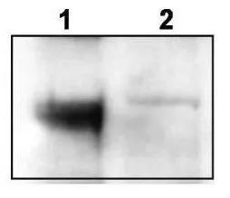 Western blot using GeneTexs affinity purified anti-TrkCT1 to detect endogenous TrkCT1 in mouse cortex lysate (Lane 1). Lane 2 is TrkCT1 knock-out cortex lysate. Cell extracts were resolved by electrophoresis and transferred to nitrocellulose. The membrane was probed with the primary antibody at a 1:6,000 dilution.