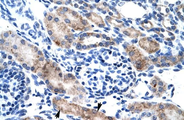 IHC-P analysis of human kidney tissue using GTX48722 CLIC1 antibody at 4.0-8.0microg/ml. IHC-P analysis of human kidney tissue using GTX48722 CLIC1 antibody at 4.0-8.0microg/ml.