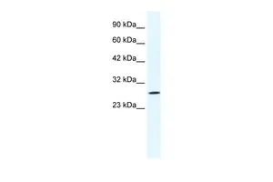WB analysis of Jurkat cells using GTX48722 CLIC1 antibody at 1.25microg/ml.
