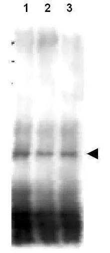 Western blot using GeneTexs affinity purified anti-S.cerevisiae Mer2 antibody shows detection of phosphorylated and unphosphorylated Mer2 in wild type, phosphatase treated and mutant cells. Lane 1 contains Mer2-myc protein detected in wild type cells after first immunoprecipitating the protein using anti-myc antibody. Cells were harvested 4 h after the initiation of meiosis and therefore contain mostly phosphorylated Mer2. Lane 2 contains the same preparation after treatment with phosphatase. Lane 3 contains Mer2-S30A protein as a phosphorylation control. This antibody is reactive with both phosphorylated and unphosphorylated Mer2 at the S30 position. The primary antibody was used at a 1:5,000 dilution. Western blot using GeneTexs affinity purified anti-S.cerevisiae Mer2 antibody shows detection of phosphorylated and unphosphorylated Mer2 in wild type, phosphatase treated and mutant cells. Lane 1 contains Mer2-myc protein detected in wild type cells after first immunoprecipitating the protein using anti-myc antibody. Cells were harvested 4 h after the initiation of meiosis and therefore contain mostly phosphorylated Mer2. Lane 2 contains the same preparation after treatment with phosphatase. Lane 3 contains Mer2-S30A protein as a phosphorylation control. This antibody is reactive with both phosphorylated and unphosphorylated Mer2 at the S30 position. The primary antibody was used at a 1:5,000 dilution.