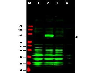 WB analysis of transfected and non-transfected lysate using GTX48743 Ajuba antibody. Lane 1 : Vector only Lane 2 : Human Ajuba-RFP Lane 3 : Mouse Ajuba-RFP Lane 4 : Mock Loading : 50 microg Dilution : 1:700