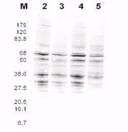 This product was assayed by western blotting against RFA2 containing cell lysates. Blot incubated for 1 hr at RT with affinity purified Rabbit anti-RFA2 pan reactive Lot 13229 at 1.0 microg/ml followed by 1:5000 dilution of IRDye800 sheep anti-Rabbit IgG for 1 hr at RT. This product was assayed by western blotting against RFA2 containing cell lysates. Blot incubated for 1 hr at RT with affinity purified Rabbit anti-RFA2 pan reactive Lot 13229 at 1.0 microg/ml followed by 1:5000 dilution of IRDye800 sheep anti-Rabbit IgG for 1 hr at RT.