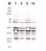 This product was assayed by western blotting against RFA2 containing cell lysates. Affinity purified rabbit anti-RFA2 pS122 specific Lot 13230 at 1.0 ug/ml for 1 hr at RT followed by IRDye 800 sheep anti-Rabbit IgG1:5000 1 hr RT.