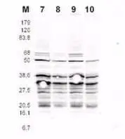 This product was assayed by western blotting against RFA2 containing cell lysates. Affinity purified rabbit anti-RFA2 pS122 specific Lot 13230 at 1.0 microg/ml for 1 hr at RT followed by IRDye 800 sheep anti-Rabbit IgG1:5000 1 hr RT. This product was assayed by western blotting against RFA2 containing cell lysates. Affinity purified rabbit anti-RFA2 pS122 specific Lot 13230 at 1.0 microg/ml for 1 hr at RT followed by IRDye 800 sheep anti-Rabbit IgG1:5000 1 hr RT.