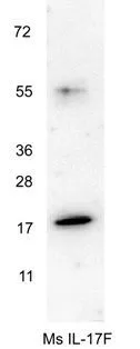 Western blot using GeneTexs anti-Mouse IL-17F antibody shows detection of a band ~18 kDa in size corresponding to recombinant mouse IL-17F. Recombinant mouse IL-17F was loaded on to an SDS-PAGE gel at 0.25 microg and after separation was transferred to nitrocellulose. The membrane was blocked with 1% BSA in TBST for 30 min at RT, followed by incubation with primary antibody diluted 1:1,000 in 1% BSA in TBST overnight at 4oC. After washes, the blot was reacted with secondary antibody HRP Goat anti-Rabbit IgG antibody diluted 1:40,000 in blocking buffer) for 30 min at RT followed by reation with FemtoMax Chemiluminescent substrate. Data was collected using Bio-Rad VersaDocR 4000 MP imaging system. Western blot using GeneTexs anti-Mouse IL-17F antibody shows detection of a band ~18 kDa in size corresponding to recombinant mouse IL-17F. Recombinant mouse IL-17F was loaded on to an SDS-PAGE gel at 0.25 microg and after separation was transferred to nitrocellulose. The membrane was blocked with 1% BSA in TBST for 30 min at RT, followed by incubation with primary antibody diluted 1:1,000 in 1% BSA in TBST overnight at 4oC. After washes, the blot was reacted with secondary antibody HRP Goat anti-Rabbit IgG antibody diluted 1:40,000 in blocking buffer) for 30 min at RT followed by reation with FemtoMax Chemiluminescent substrate. Data was collected using Bio-Rad VersaDocR 4000 MP imaging system.