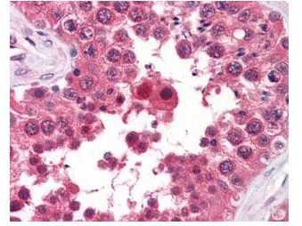 GeneTexs anti-AHA1 monoclonal antibody was used at a 5-10 microg/mL to detect AHA1 in the seminiferous tubule of human testis (40X) showing moderate staining. Leydig cells showed faint to moderate staining. Expression of AHA1 is reported in many epithelial and lymphatic tissues, with cytoplasmic localization. This antibody showed moderate cytoplasmic staining of a variety of epithelial tissues and lymphoid organs such as spleen and tonsil with minimal background staining. The image shows the localization of the antibody as the precipitated red signal, with a hematoxylin purple nuclear counterstain. Tissue was formalin-fixed and paraffin embedded.