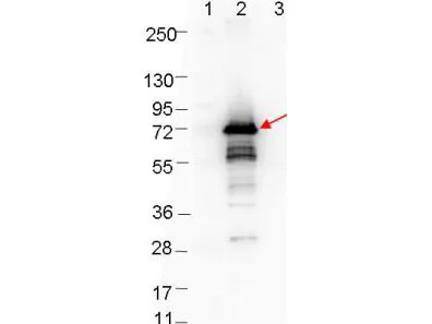 WB analysis of various samples using GTX48804 Borrelia burgdorferi Osp A antibody. Lane 1 : Protein ladder Lane 2 : MBP-Osp A fusion protein Lane 3 : MBP Loading : 0.1 microg Dilution : 1:1000