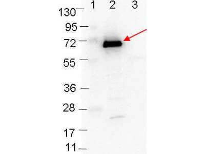 WB analysis of various samples using GTX48806 Borrelia burgdorferi Osp C antibody. Lane 1 : Protein ladder Lane 2 : MBP-Osp C fusion protein Lane 3 : MBP Loading : 0.1 microg Dilution : 1:1000
