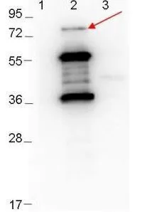 Western Blot showing detection of 0.1 microg recombinant proteins in western blot. Lane 1: Molecular weight markers. Lane 2: MBP-ErpD/Arp37 fusion proteins (arrow: expected MW of major band: 73.3 kDa). Lane 3: MBP alone. Protein was run on a 4-20% gel, then transferred to 0.45 microm nitrocellulose. After blocking with 1% BSA-TTBS overnight at 4oC, primary antibody was used at 1:1000 at room temperature for 30 min. HRP-conjugated Goat-Anti-Rabbit secondary antibody was used at 1:40,000 in blocking buffer and imaged on the VersaDoc MP 4000 imaging system (Bio-Rad). Western Blot showing detection of 0.1 microg recombinant proteins in western blot. Lane 1: Molecular weight markers. Lane 2: MBP-ErpD/Arp37 fusion proteins (arrow: expected MW of major band: 73.3 kDa). Lane 3: MBP alone. Protein was run on a 4-20% gel, then transferred to 0.45 microm nitrocellulose. After blocking with 1% BSA-TTBS overnight at 4oC, primary antibody was used at 1:1000 at room temperature for 30 min. HRP-conjugated Goat-Anti-Rabbit secondary antibody was used at 1:40,000 in blocking buffer and imaged on the VersaDoc MP 4000 imaging system (Bio-Rad).