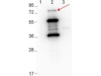 WB analysis of various samples using GTX48808 Borrelia burgdorferi Erpd/Arp37 antibody. Lane 1 : Protein ladder Lane 2 : MBP-Erpd/Arp37 fusion protein Lane 3 : MBP Loading : 0.1 microg Dilution : 1:1000