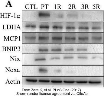 The data was published in the journal PLoS One in 2017. PMID: 29045486