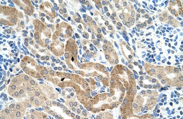 IHC-P analysis of human kidney tissue using GTX48890 CHAF1B antibody at 4.0-8.0microg/ml. IHC-P analysis of human kidney tissue using GTX48890 CHAF1B antibody at 4.0-8.0microg/ml.