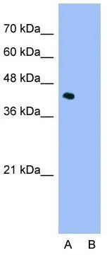 WB analysis of Jurkat cells using GTX49071 ILF2 antibody at 2.5microg/ml. Lane A : Primary antibody Lane B : Primary antibody + blocking peptide