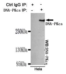 IP analysis of HeLa lysates using control IgG and DNA-PKcs antibody. The precipitates were detected by the same DNA-PKcs antibody.