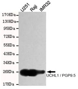 WB analysis of U251, Raji and IMP32 lysates using PGP9.5 antibody at a dilution of 1:1,000.