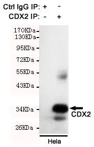 IP analysis of HeLa lysate using control IgG and CDX2 antibody. The precipitates were detected by the same CDX2 antibody.
