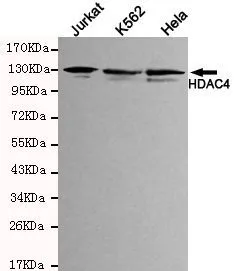 WB analysis of Jurkat, HeLa and K562 lysates using HDAC4 antibody at a dilution of 1:1,000.