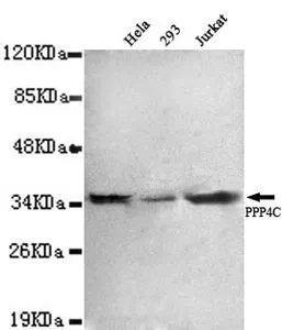 WB analysis of HeLa, 293 and Jurkat lysates using PPP4C antibody at a dilution of 1:1,000.