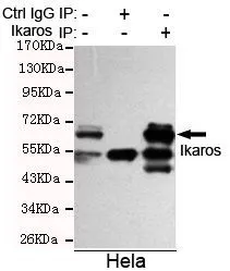 IP analysis of HeLa lysate using control IgG and Ikaros antibody. The precipitates were detected by the same Ikaros antibody. IP analysis of HeLa lysate using control IgG and Ikaros antibody. The precipitates were detected by the same Ikaros antibody.