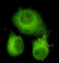 ICC/IF analysis of HeLa cells using ATP-Citrate Lyase antibody at a dilution of 1:150.