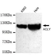WB analysis of K562 and HeLa lysates using ATP-Citrate Lyase antibody at a dilution of 1:1,000.