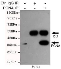 IP analysis of HeLa lysates using control IgG and PCNA antibody. The precipitates were detected by the same PCNA antibody.
