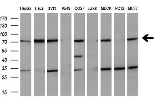 WB analysis of various cell lines using GTX49358 MTMR2 antibody [5G5]. Loading : 35 ug per lane Dilution : 1:200