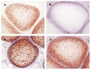 Immunohistochemical staining of a formalin-fixed, paraffin-embedded fetal bone anlage in the hand (around week 10) with GTX49365.