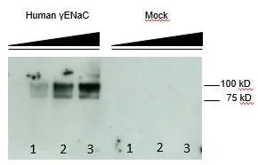 WB performed with GTX49366 on a lysate of HEK293 cells transfected with and without ?ENaC.