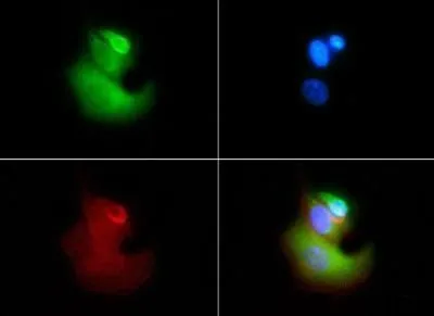 ICC/IF analysis of HeLa cells using GTX49372 VLDL Receptor antibody [6A6]. Green : primary antibody Red : Actin Blue : DAPI