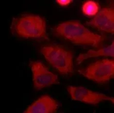 Immunofluorescence of human HeLa cells stained with Hoechst 3342 (Blue) for nucleus staining and monoclonal anti-human LDHA antibody (1:500) with Texas Red (Red).