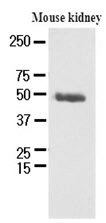 The extracts of mouse kidney (60ug) were resolved by SDS-PAGE, transferred to NC membrane and probed with anti-human PSMD11 (1:250). Proteins were visualized using a goat anti-mouse secondary antibody conjugated to HRP and an ECL detection system