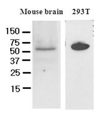 Cell lysates of mouse brain and 293T (50ug) were resolved by SDS-PAGE, transferred to NC membrane and probed with anti-human DACT3 (1:250). Proteins were visualized using a goat anti-mouse secondary antibody conjugated to HRP and an ECL detection system.