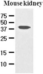The extracts of mouse kidney (50ug) were resolved by SDS-PAGE, transferred to NC membrane and probed with anti-human PDCD12 (1:1000). Proteins were visualized using a goat anti-mouse secondary antibody conjugated to HRP and an ECL detection system. The extracts of mouse kidney (50ug) were resolved by SDS-PAGE, transferred to NC membrane and probed with anti-human PDCD12 (1:1000). Proteins were visualized using a goat anti-mouse secondary antibody conjugated to HRP and an ECL detection system.