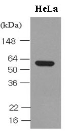 Cell lysates of HeLa (30ug) were resolved by SDS-PAGE, transferred to NC membrane and probed with anti-human Hsp60 (1:1,000). Proteins were visualized using a goat anti-mouse secondary antibody conjugated to HRP and an ECL detection system.