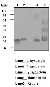 The recombinant human synuclein family (alpha-,beta- and gamma-) (each 20ng),Mouse brain and Rat brain (30ug) were resolved by SDS-PAGE,transferred to PVDF membrane and probed with anti-human alpha,?-synuclein (1:1000). Proteins were visualized using a
