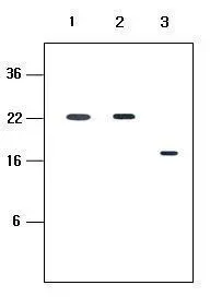 Human recombinant protein kIR2DL1,kIR2DL3 and kIR2DL4 (each 20ng per well) were resolved by SDS-PAGE,transferred to PVDF membrane and probed with anti-human kIR2D (1:500). Proteins were visualized using a goat anti-mouse secondary antibody conjugated t