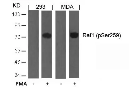 WB analysis of extracts from 293 and MDA cells untreated or treated with PMA using GTX50094 Raf1 (phospho Ser259) antibody.